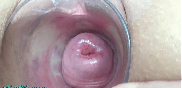  Extreme Double Anal and Pussy Fucking Dildo and Peehole Play